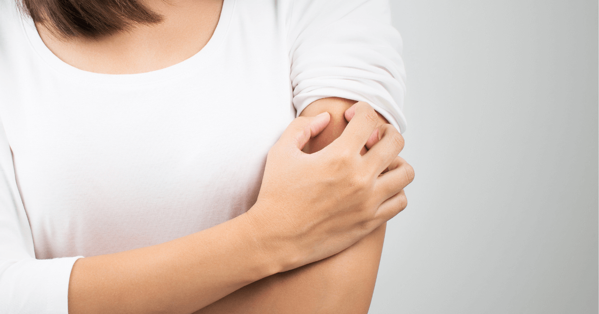 冬の乾燥で腕のかゆみに悩む女性のイメージ